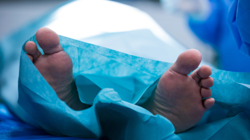 20260402 Autopsie lijkschouw mortuarium Freepik