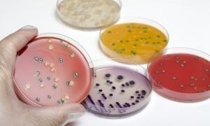 17957 Listeria monocytogenes 300x190