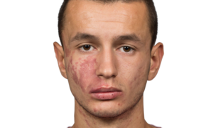 244944 Bersant Celina 3 1