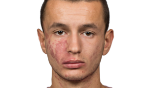 255903 Bersant Celina 3 2
