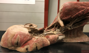 268715 humanbodies