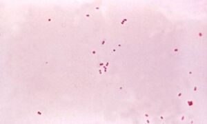 367226 Neisseria meningitidis
