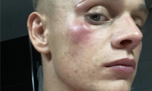 452866 dennis schouten