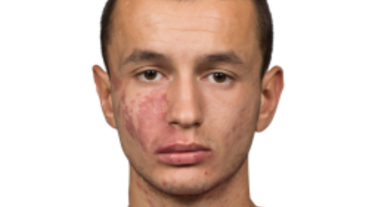 246185 245727 244944 Bersant Celina 3 1