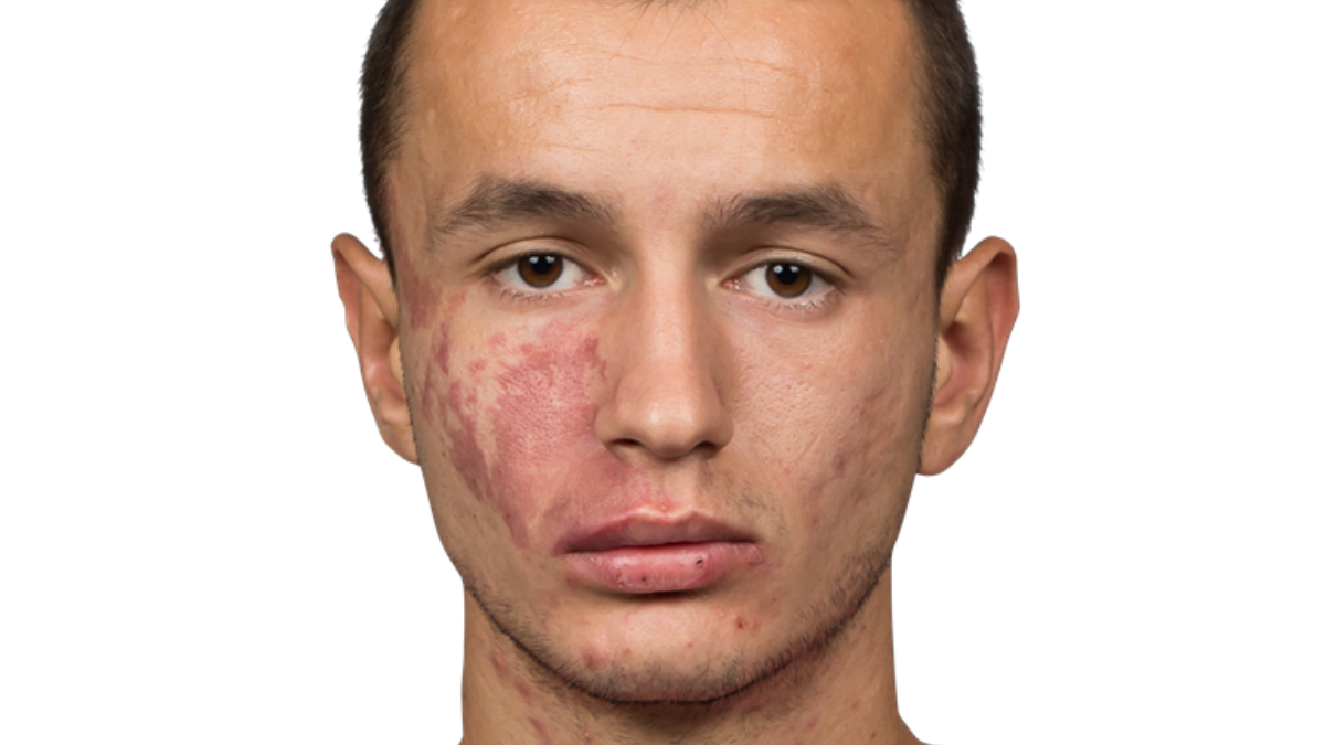 255903 Bersant Celina 3 2