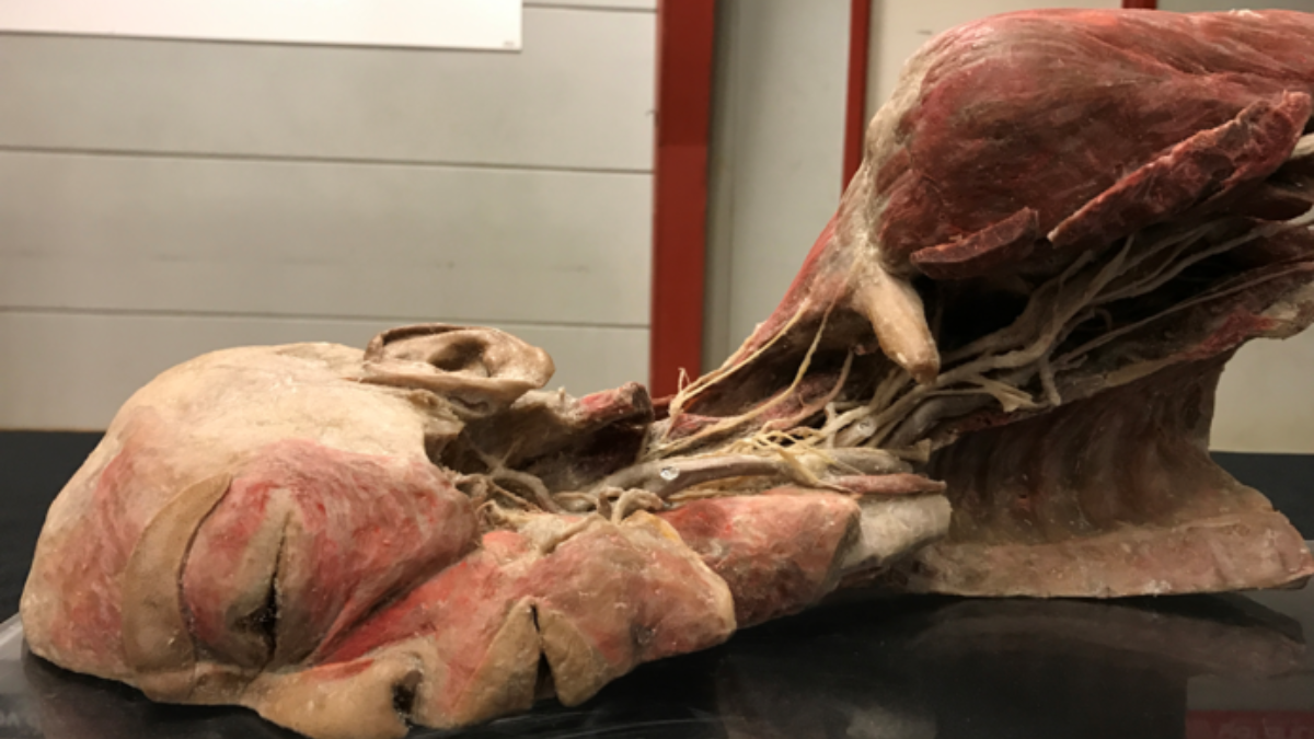 268715 humanbodies