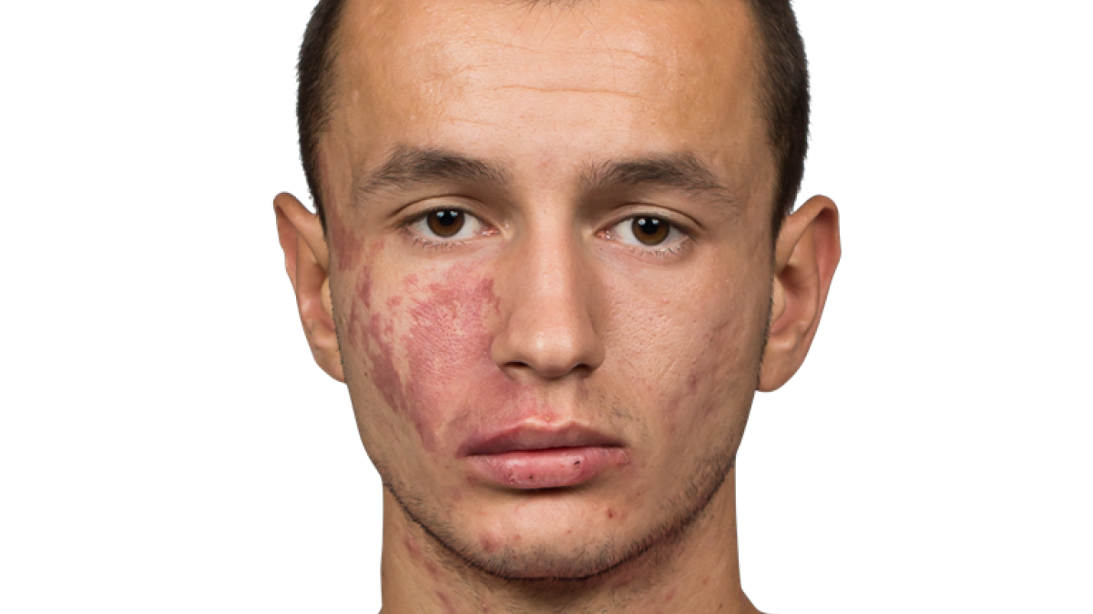 275344 Bersant Celina 3 3